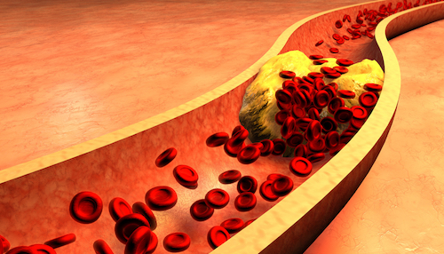 The Truth About Cholesterol and What You Can Do About It